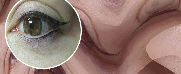 Permanent eyeliner lower lid