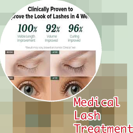 Does lash therapy work